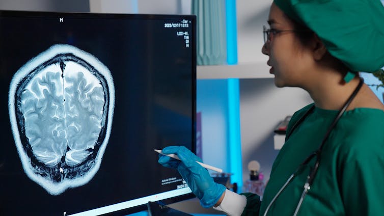 Surgeon examines an MRI of the brain